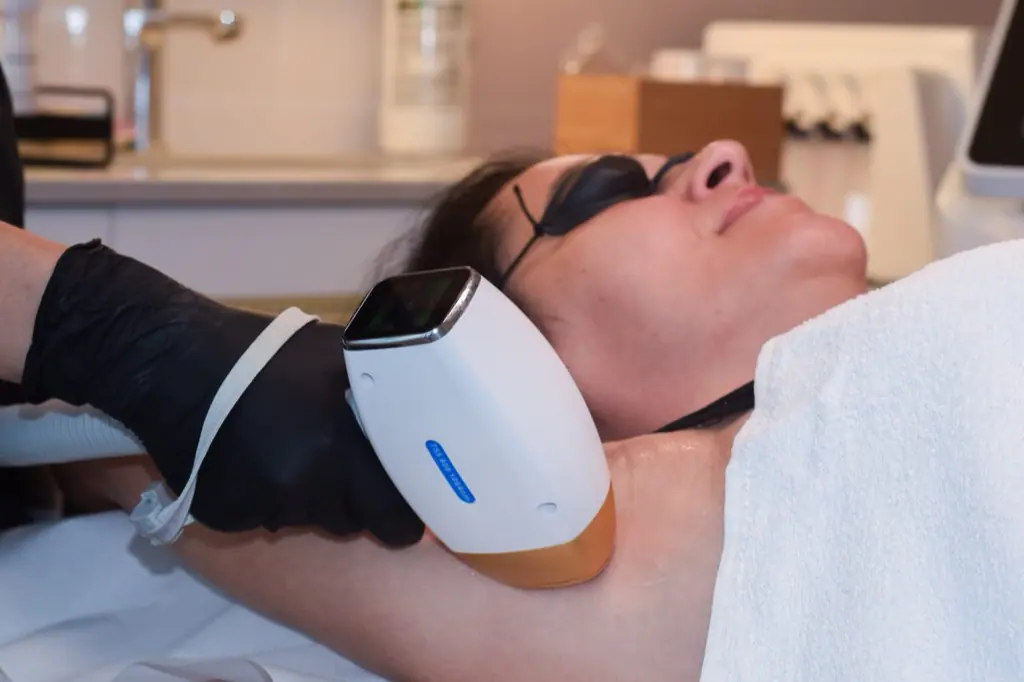 Ședință de epilare definitivă cu laser, clienta poartă ochelari de protecție